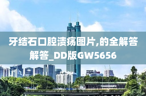 牙结石口腔溃疡图片,的全解答解答_DD版GW5656